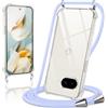 Coiwxmoi Cover per Google Pixel 9A con Cordino 6,3,Trasparente Custodia con Laccio Tracolla Corda Catena Cinghia,Ultra Morbido Silicone TPU Antiurto Case per Google 9A 5G, Viola