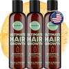 Moerie Ultimate Hair Growth Shampoo - For Longer, Thicker, Fuller Hair - Vegan Friendly Volumizing Hair Products - Paraben & Silicone Free - All Hair Types - Reverse Hair Loss - 8.45 fl oz, Triple Set