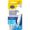 Scholl Freeze Verruca Rimozione Virus Bomboletta + 12 Applicatori