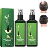 Grgowe 2Pc Siero Per La Crescita Dei Capelli Allo Zenzero, Spray Nutriente Allo Zenzero, Per Uomini e Donne, Crescita Naturale Veloce Dei Capelli