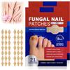 TaimeiMao 42 pcs Cerotti per Unghie, Toenail Correction Patch, Toppa per la correzione delle unghie dei piedi, Rafforzare Le Unghie, Riparare Unghie Danneggiate e Migliorare l'aspetto Delle Unghie Scolorite