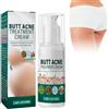 Nurvidis Crema Schiarente Per L'acne, Crema Per Il Trattamento Dei Glutei, Culo Acne Crema, Crema Per Glutei Brufolo, Ripristina La Pelle Del Sedere Morbida E Liscia, 100ml(A)