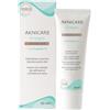 Aknicare Cream Teintee Dore' 50 ml Crema