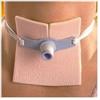 Allevyn MEDICAZIONE IDROCELLULARE STERILE PER TRACHEOSTOMIA NON ADERENTE IN SCHIUMA DI POLIURETANO ALLEVYN TRACHEOSTOMY 9X9CM 10 PEZZI
