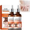 Beslibate 2PC Underarm Whitening Essenza, Essenza Sbiancante Ascelle, Sbiancamento Essenza, Essenza Schiarente Per Area Privata, per Ascelle, Ginocchia, Gomiti, Zone Sensibili E Intime, Bianchi, serum8-5
