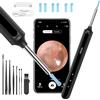 Qimic Otoscopio, Rimozione di Cerume con Telecamera, 1080P 3,5mm Impermeabile Endoscopio con 6 Luci LED, Pulisci Orecchie per iPhone, iPad e Android