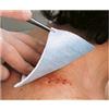 LOHMANN MEDICAL METALLINE-10CM X12CM 10CPR