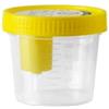 ANGELINI Raccoglitore Sterile Urina/Urinocoltura 1 barattolo da 120ml