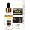 Ammuri Total Hair Repair Growth Serum Siero anticaduta a base di erbe naturali, per la calvizie, il diradamento, ripara i follicoli piliferi e promuove una ricrescita più spessa per uomini e donne