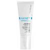 Aknet Dermocontrol 40ml