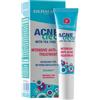 Dermacol AcneClear Intensive Anti-Acne Treatment Trattamento viso 15 ml