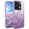 Custodia Glitter Rosa Per Xiaomi Redmi Note 10 Pro 5G - Cover In TPU Morbida Con Protezione Fotocamera E Schermo, Leggera E Resistente - 3