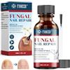 home harbor 30ml Riparazione Unghie,Con strisce di smalto e pennelli,Trattamento Antimicotico Unghie Piedi,Ripara e Proteggi le Unghie Fragili,Riparazione Unghie per Rinforza la struttura dell'unghia