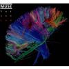 Muse - The 2nd Law (CD + DVD, Album, Deluxe Edition, 2012)