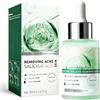 Uheltosly 30ml Siero Anti Acne per Viso,Efficace Essenze per Viso,Adatto a Tutti i Tipi di Pelle, Aiuta a Ridurre Brufoli e Imperfezioni,Essenze Skincare Per Tutti i Tipi di Pelle,per uomini che donne(Bianco)