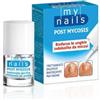 My Nails Post Mycosis 5ml