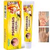 MagiSel Creme per la Psoriasi, Crema Idratante 20g Crema per l'eczema Creme Antiprurito, Psoriasis Cream Corpo per pelle Secca, Allevia efficacemente il prurito, Pelle Secca