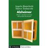 Alzheimer