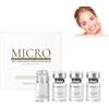 Wootapson Microneedling Viso Set,Set di Sistema di Infusione con Microneedling, Micro Infusion System,Facial Serum,Ridurre le Rughe e Rassodare la Pelle, Adatto a Tutti i Tipi di Pelle