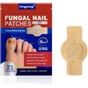 Fengyang® Fungal Nail Patches, Parches Para El Cuidado De Las Uñas, Traspiranti E Asciutti, Efficace Contre Les Infections Fongiques