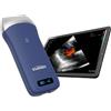 GIMA ECOGRAFO PORTATILE LINEARE WIRELESS VIATOM - connessione smartphone e imaging ad alta frequenza