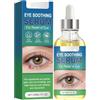Mnozreo Milia Removal Spot Care,Siero per Occhi con Particelle di Grasso,30ML,1PC,Rimozione di Macchie Scure della Pelle