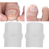 YUYTE 2pcs Silicone Strumento per la Correzione Dell'unghia Incarnita, Toppa Elastica per Unghie dei Piedi Curve Adesivi per Bretelle, Sollievo Dal Dolore Trattamento Paronichia Correttore Cura delle Unghie