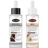 ZKUNL Rice Ampoule Duo, Peeling Chimico Viso, Esfoliante Viso Black and White Rice Peeling Ampoule per Eliminare le Cellule Morte,Adatto alla maggior parte dei tipi di pelle, 2 * 80ML