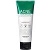 Some By Mi Aha-Bha-Pha 30 Day Miracle Acne Clear Foam 100 ml Schiuma