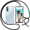 ISOI Cover con Cordino per Samsung Galaxy A17 4G/Samsung Galaxy A17 5G, Custodia Trasparente con Collana Tracolla Laccio Collo Ultra Sottile Morbido TPU Silicone Antiurto AntiGraffio Case, Nero