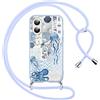 Yoedge Cover con Cordino per iPhone 16, Custodia con Laccio Collana Regolabile Tracolla Aesthetic Conchiglie Disegni, Morbida Silicone TPU Necklace Protettiva Corda Case per iPhone 16 6,1, Blu