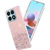 Yarxiawin Custodia per Honor X8A Silicone Rosa, Effetto Glitter per Honor X8A Cover Trasparente Brillante Morbida Sottile Case Regalo per Donne (Rosa)