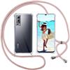 ISOI Cover con Cordino per Vivo Y52 5G/Vivo Y72 5G, Custodia Trasparente con Collana Tracolla Laccio Collo Ultra Sottile Morbido TPU Silicone Antiurto AntiGraffio Case, Rosa