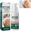 GNAUMORE Crema Per Il Trattamento Dei Glutei - Schiarente Per L'acne, Brufolo Culo e Sedere 1PC