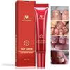 YALFEN Crema Ungueale a Base di Erbe, Crema Protettiva per la Cura della Pelle Trattamento Unguento a Base di Dita Unghie Onicomicosi Paronychia Trattamento Anti-fungo Crema per Riparazione Unghie, 15g