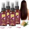 Raevior Olio per capelli con cipolla rossa spray, cipolla e rosmarino Cura Crescita Capelli, Siero Olio di Cipolle, Zenzero & Vitamina E, Rafforza radici, Riduce la rottura, dona volume e lucentezza (4 pezzi)