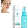 Generico Spray all'acido ipocloroso per il viso, spray idratante per pelli sensibili, spray all'acido ipocloroso per pelli arrossate e gonfie, emulsione calmante per pelli rotte per (1pcs)
