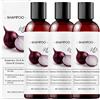 Sgjwyc Shampoo alla cipolla per la crescita dei capelli, olio di rosmarino e cipolle rosse e estratto di cannella, shampoo anti-caduta dei capelli, cura nutriente, favorisce capelli più densi e pieni per