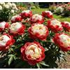 NYUYDRX Rizomi di peonia - Rizomi di peonia sfusi in vendita - Arbusto robusto - Perenni resistenti e robusti - Decorazione da giardino-1 unità-E
