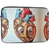 DMORJ Custodia portatile antiurto per computer portatile con grafico cardiaco umano anatomia: viaggio d'affari da 12 pollici, viaggio, scuola, ufficio, per uso quotidiano.
