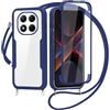 FERLAN Cover per Xiaomi Poco X7 con Cordino, 360 Gradi Antiurto Custodia con Protezione Schermo Integrata Trasparente Rugged TPU Bumper Doppia Protettiva Cover per Xiaomi Poco X7 -Blu