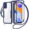FERLAN Cover per Redmi Note 11 Pro/Note 12 Pro 4G con Cordino, 360 Gradi Antiurto Custodia con Protezione Schermo Integrata Trasparente Rugged TPU Bumper Doppia Protettiva Cover - Blu
