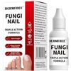 Ackygetrich Trattamento per Funghi delle Unghie dei Piedi Extra Forte, Soluzione Antifungina per Unghie dei Piedi o delle Mani, Formula a Tripla Azione per Rimuovere i Funghi, Riparare e Rinnovare le Unghie