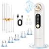 aquota Rimuove i punti neri elettrici, pulitore pori, pulizia del viso USB, ricaricabile, per rimuovere brufoli Blackhead Remover acne bianco per rimuovere punti neri con 4 livelli di aspirazione e 4 teste