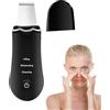 Vmiorzq Skin Scraper Per Viso - Spatola Viso Esfoliatore Cutaneo Ricaricabile,Macchina Ad Ultrasuoni, Apparecchio Per La Rimozione Delle Macchie, Massaggiatore Lifting Mento, Naso, Fronte, Guance