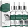 Fokayo Nuovo siero nano gocce per occhi, sollievo dall'affaticamento degli occhi, idratazione istantanea, adatto per stanchi, stressati e secchi, 30 ml (3pcs)
