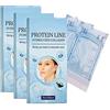 Qklovni 60 pz/scatola Instalift Coreano Solubile Filato Proteina Solubile Set di Sollevamento, Collagene Assorbibile Filo per Face Lift (3 pezzi)