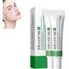 ZMMQ Whitening Freckle Cream,Acne Scar Removal Treatment Cream,Pigmentation Removal Cream For Face,Remove Melasma Acne Cream Fading Spot Cream,Dark Spot Corrector For Face (Acne Relief-2PCS)