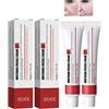 HADAVAKA 2 Pcs Whitening Freckle Cream, Spot-off Freckle Whitening Cream, Remove Melasma Cream, Acne Scar Removal Cream, Remove Melasma Melanin Dark Spots, Skin Whitening Cream (2 Anti-Blemish Cream)