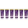 Hope's Relief - Crema naturale intensiva per pelle secca, confezione da 6 pezzi, per viso, mani, corpo, eczema, psoriasi e dermatite, ideale per pelli secche e pruriginose e irritate, 60 g
